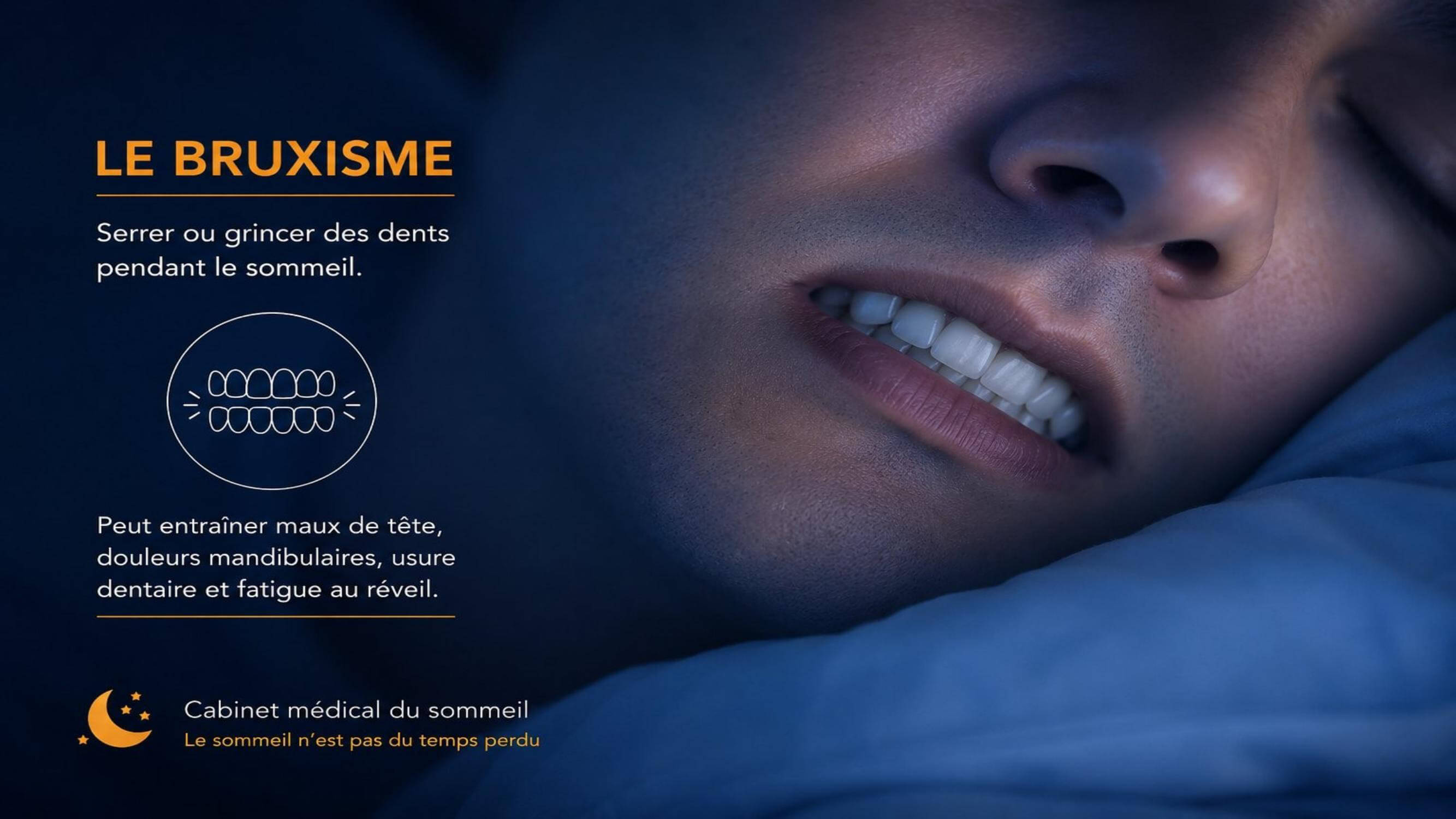 Bruxisme
